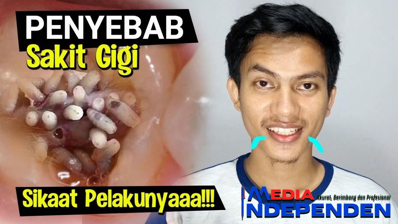 Sakit Gigi